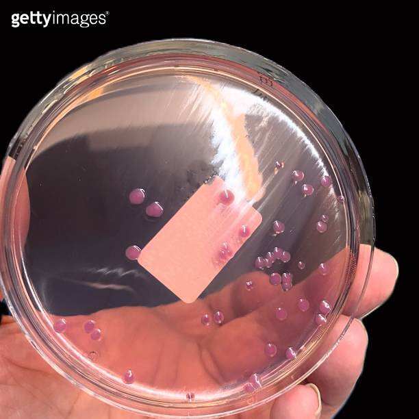 Examination of Salmonella bacterium for antibiotic sensitivity in the