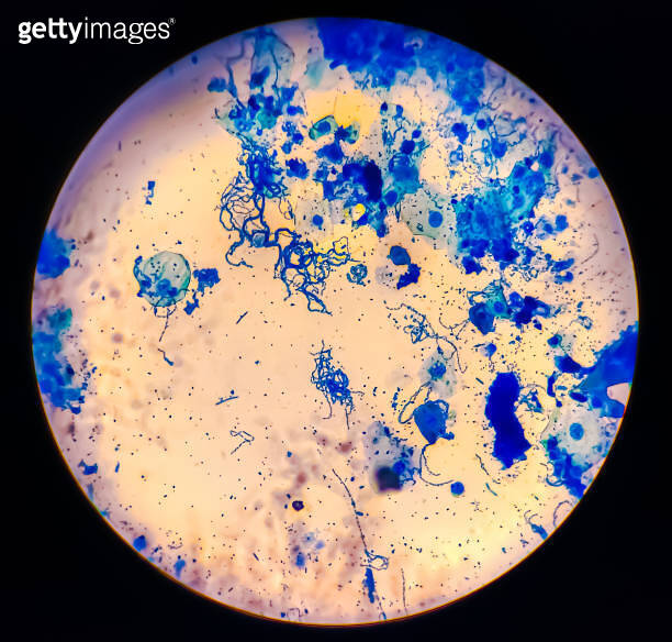 Streptococcus pyogenes and pneumonia bacteria micrograph. 이미지 ...
