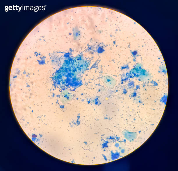 Bacterial cells chains