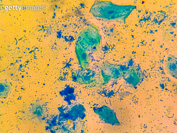 Bacterial cells chains