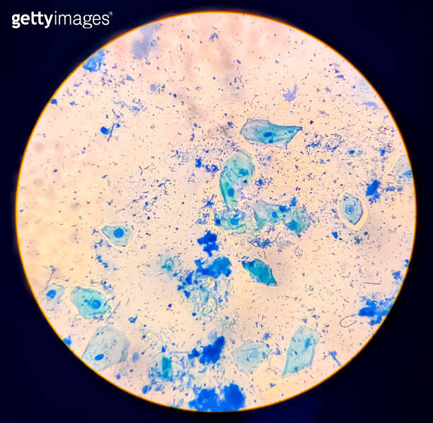 Streptococcus pyogenes and pneumonia bacteria micrograph. 이미지 ...