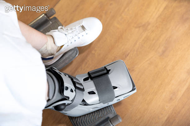 Fifth Metatarsal Fractures in Basketball: What Duke's Caleb Foster ...