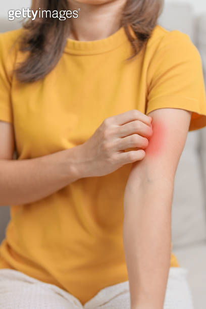 woman itching and scratching itchy arm. Sensitive Skin Allergic ...