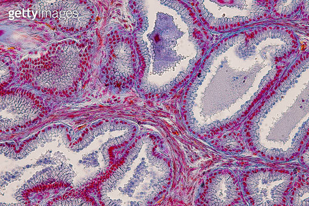 Anatomy and Histological Uterine tube, Uterus, Vagina, Ovary and Testis ...