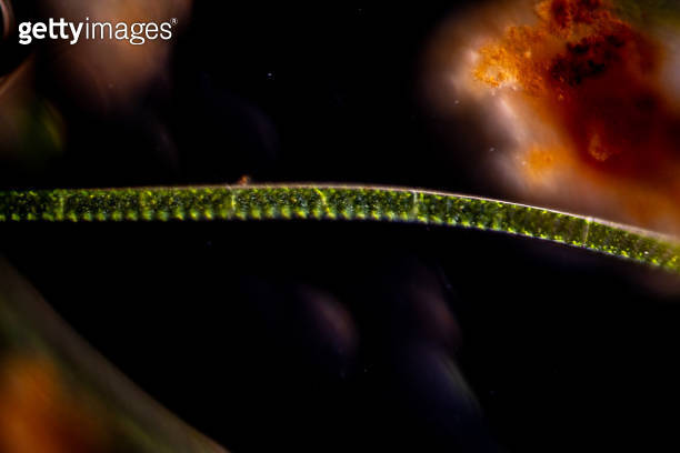 Study of Protozoa, Algae and bacteria under the microscope for ...