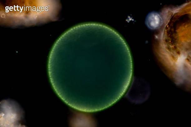 Study of Protozoa, Algae and bacteria under the microscope for ...