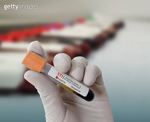 Doctor hold Blood sample for STI (Sexually Transmitted Infection) Test ...