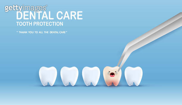 Dental care illustration set. dentists treat tooth decay to avoid pain ...